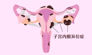 为什么这么多女性不孕不育？触目惊心的数据