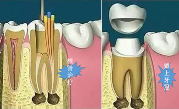 心脏绞痛胸闷气短怎么回事